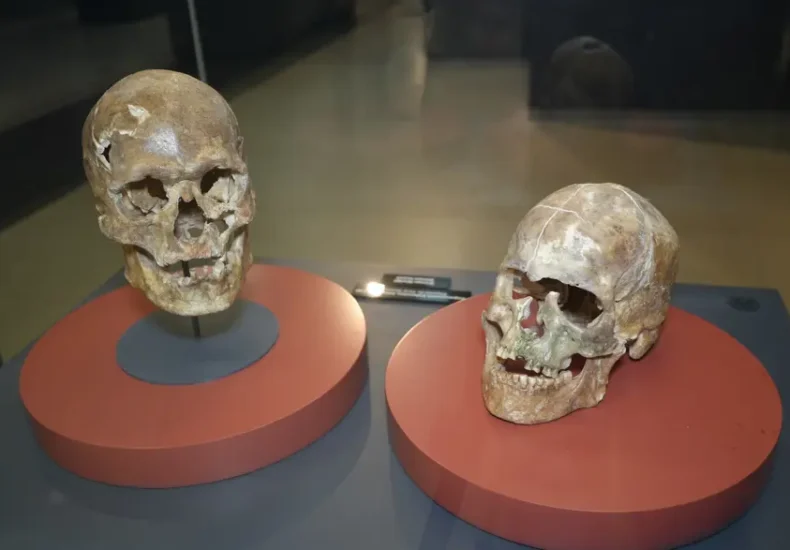 Un craniu vechi de 5.000 de ani dezvăluie primele intervenții chirurgicale craniene din Anatolia