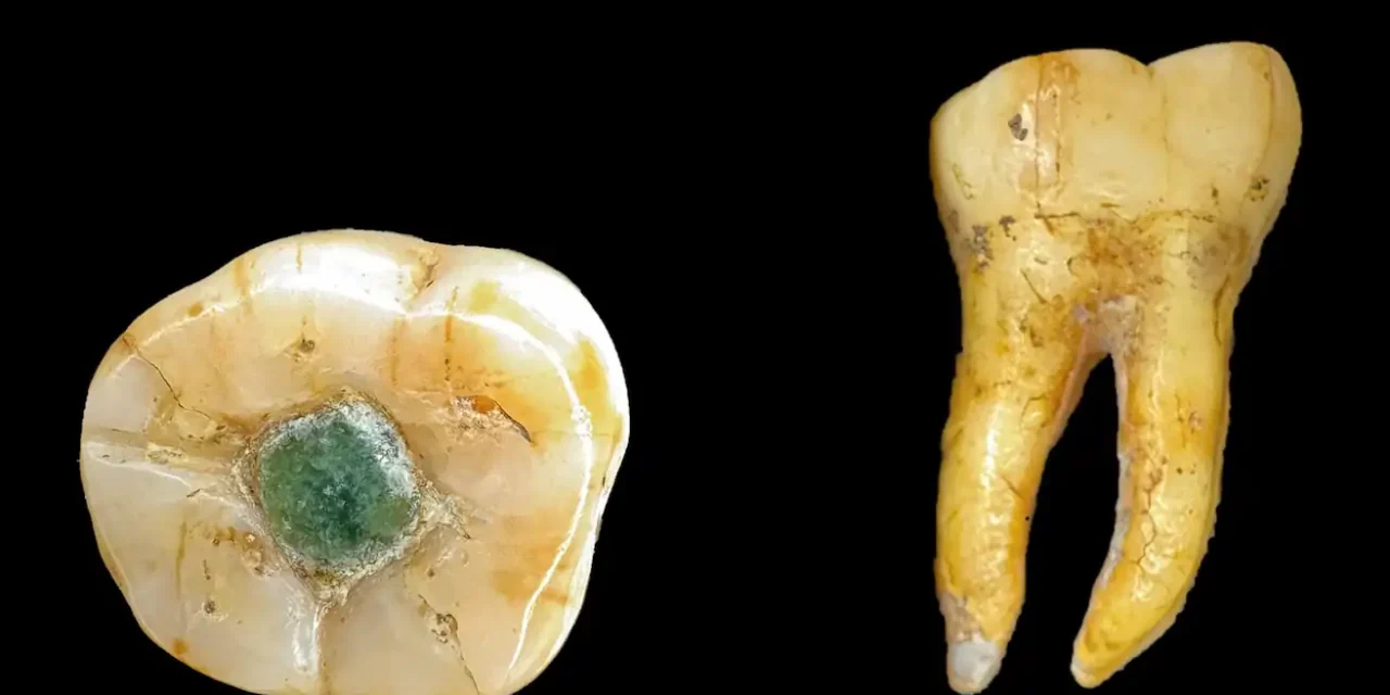 Descoperire șocantă: mayașii foloseau pietre prețioase ca plombe dentare